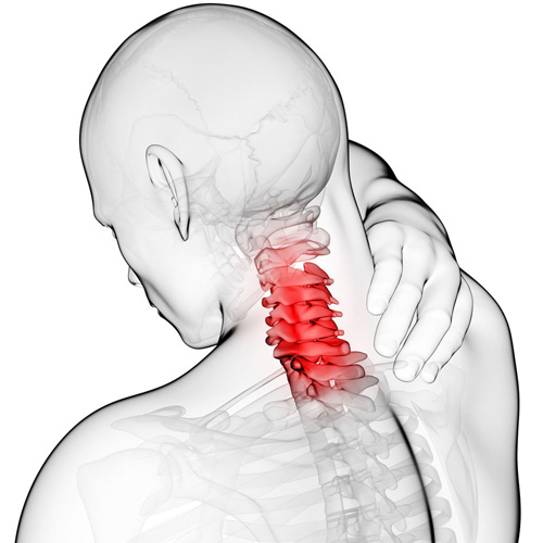 Cervical Strain