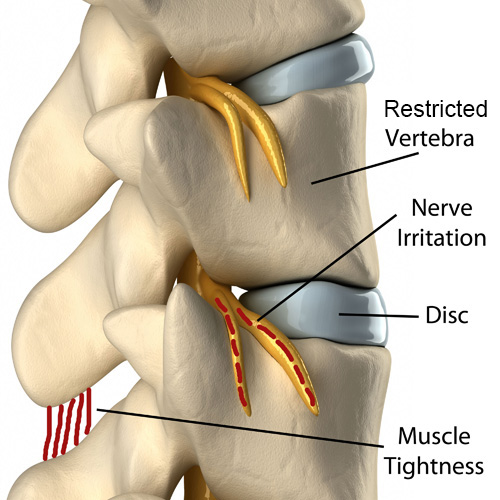 T Spine Joint