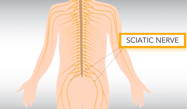 sciatic